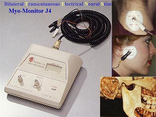 Myo-monitor J4