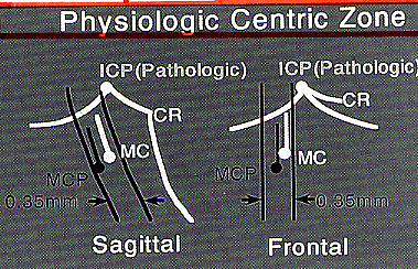 Physiologic Centric Zone