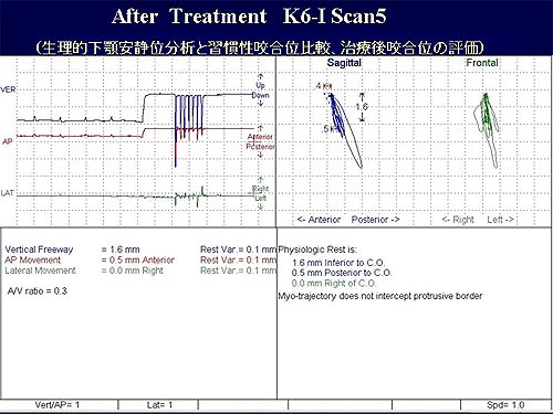 S5 2year post-operative